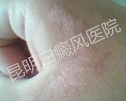 ���紫Ⱦ��