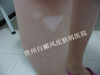 �Ų�������ɢ��ԭ��