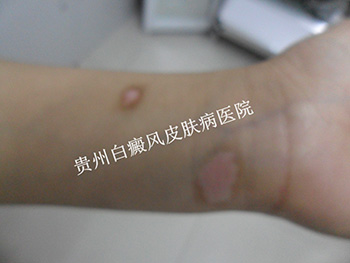 �ֱ۰�������Щ����֢״����?