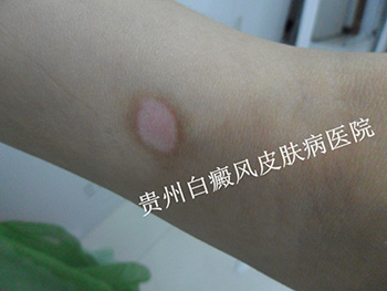 ˫�ְ����������ƺã�