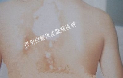 ��η�ֹ����������ɢ