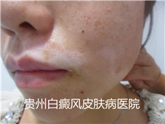 �����沿�����ԭ��