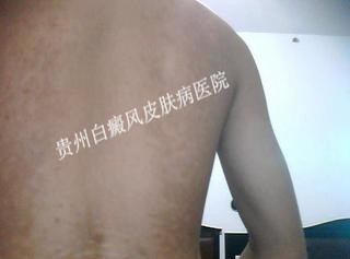 �����������Ҫԭ����ʲô