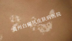 ���������Σ�����˽����