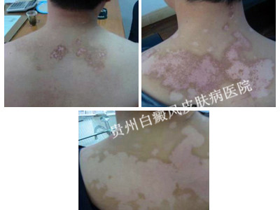 ��������Ĳ���