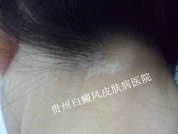 �����װ߳��ֵ�ԭ����ʲô��