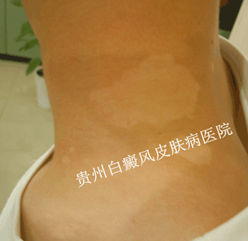 �����ϵİ���Ϊʲô�Ḵ����