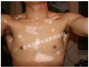 �ز�������ʲô����Σ��