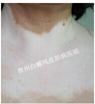 �ز��������ν���Ԥ���أ�