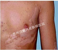 �ز�������ɢ��ԭ������Щ��