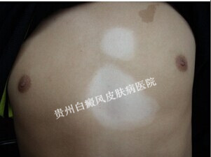 ��ô����ز����磿