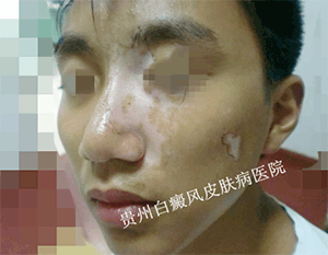 �沿�����Σ��������