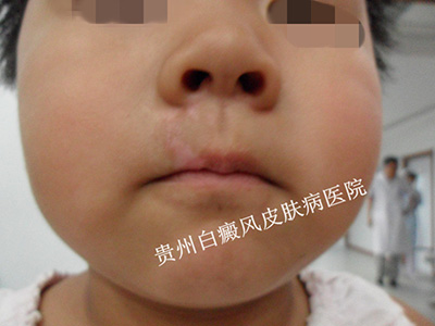 ��ͯ�������˰�����ô��ã�