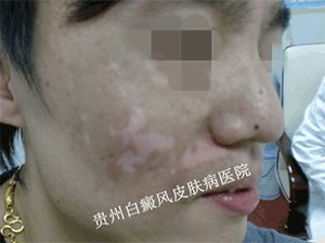 �����沿������Ҫע��ʲô��