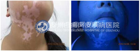 帽檐下的青春 重展双翅自由飞翔