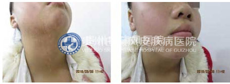 帽檐下的青春 重展双翅自由飞翔