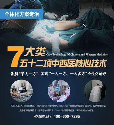 白癜风能治好吗?