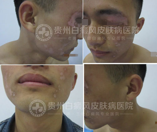 【第18封感谢信】医者仁心感动病友,康复后送感谢信致谢