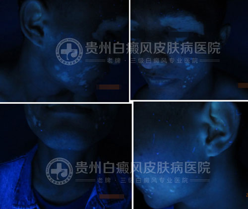 【第18封感谢信】医者仁心感动病友,康复后送感谢信致谢