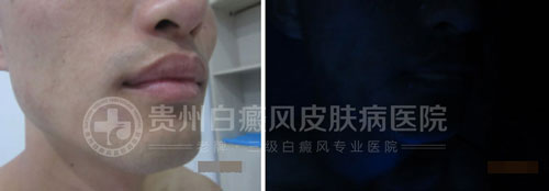 【第18封感谢信】医者仁心感动病友,康复后送感谢信致谢