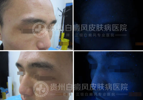 【第18封感谢信】医者仁心感动病友,康复后送感谢信致谢