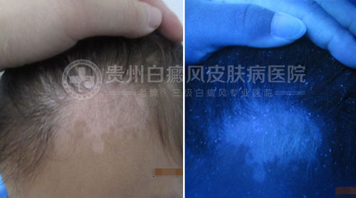 精心治疗助人康复,用心服务赢得赞扬