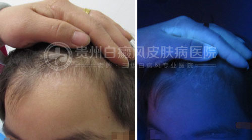 精心治疗助人康复,用心服务赢得赞扬